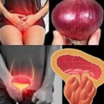 Mejora tu Salud Urinaria de Forma Natural con Cebolla y Otros Remedios Caseros