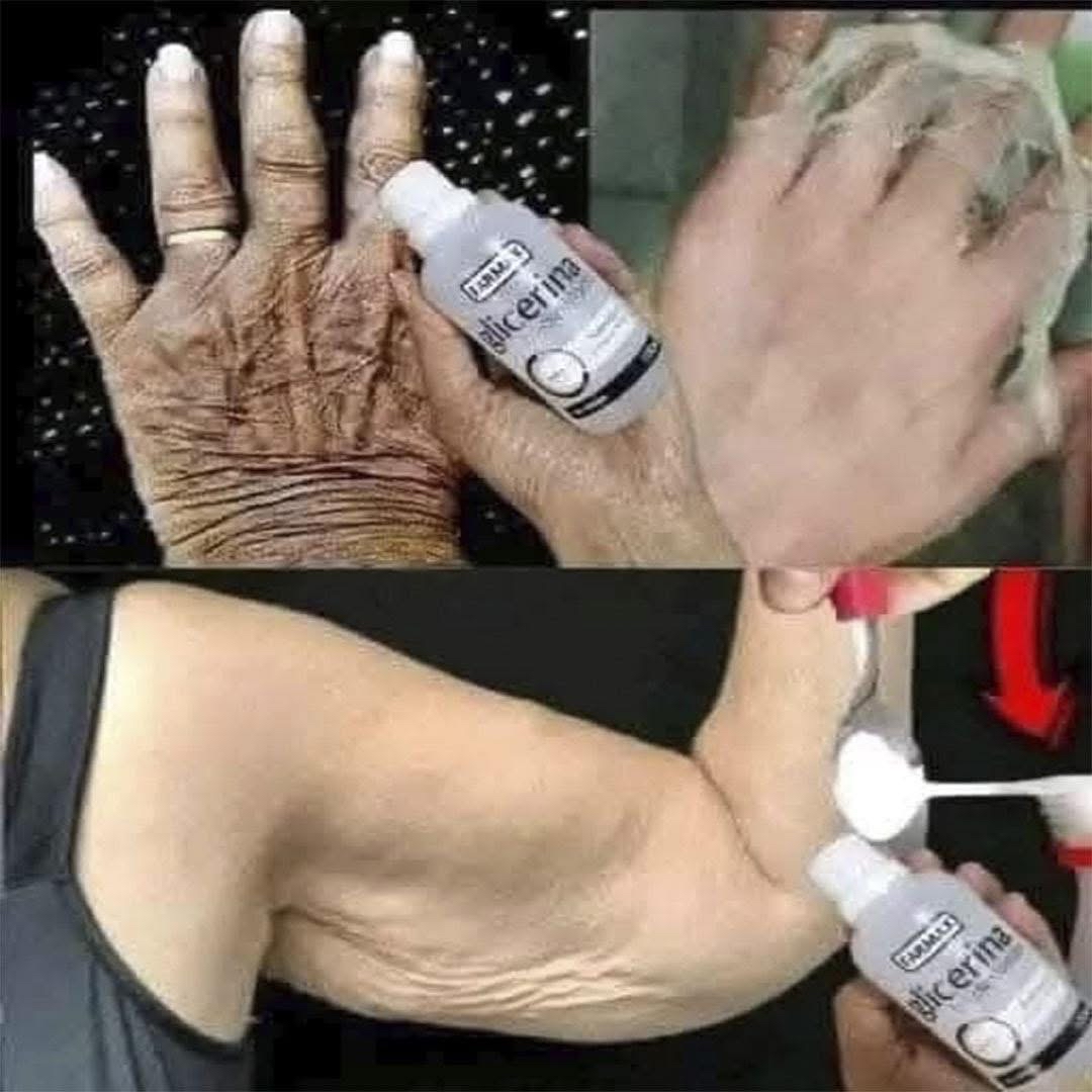 Aplicación de glicerina en la piel