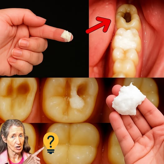 Remedio natural para caries