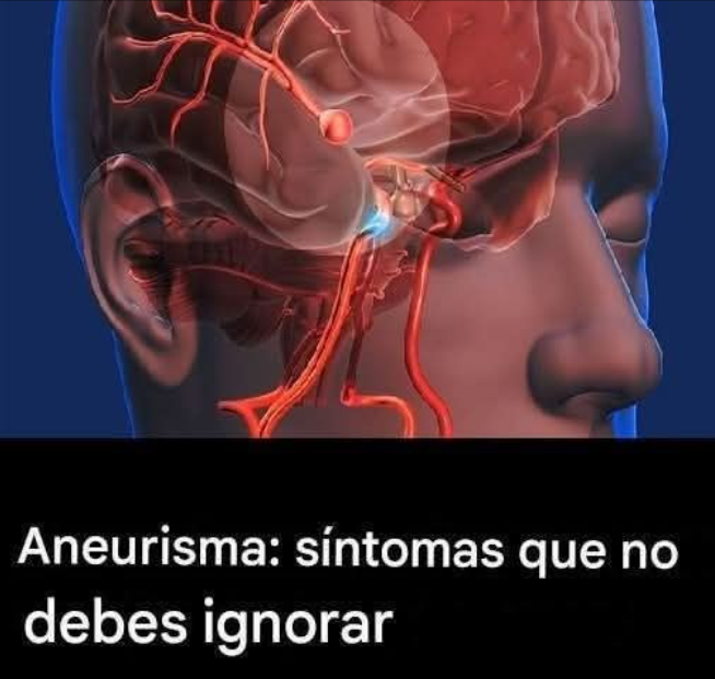 Aneurisma cerebral