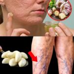 18 Maneras Eficaces de Usar el Ajo para Tratar Problemas de Salud Comunes