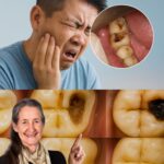 Consejos Prácticos para Mantener una Salud Dental Óptima y Reparar Caries de Forma Natural