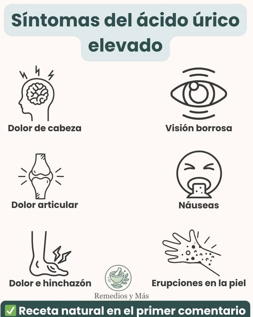 Síntomas de ácido úrico elevado