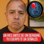 Señales de Alerta: Cómo Detectar un Derrame Cerebral Antes de que Sea Muy Tarde