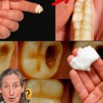 Cómo Usar Bicarbonato de Sodio para Combatir la Caries Dental de Forma Natural