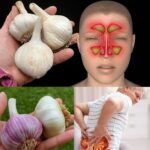 El Ajo: Tu Solución Natural para Infecciones del Tracto Urinario