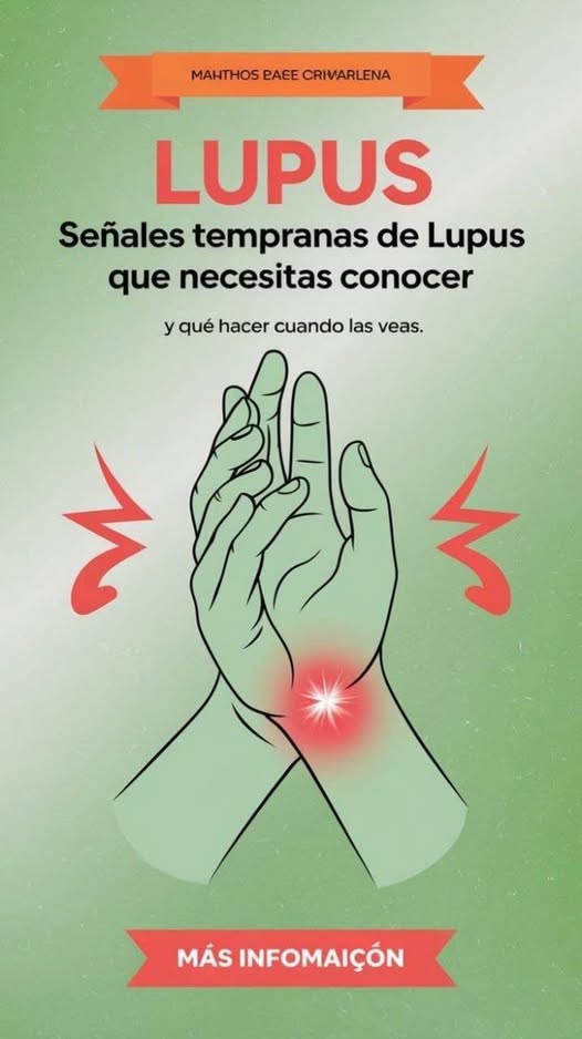Señales tempranas de Lupus