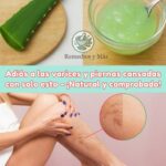 Dile Adiós a las Venas Varicosas y Piernas Pesadas con Aloe Vera