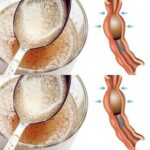 Beneficios del Psyllium: Un Remedio Natural para la Salud Digestiva