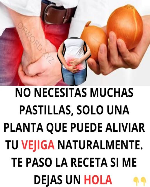 Cebollas