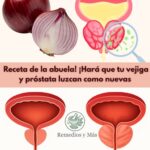 Remedios Naturales con Cebolla y Cáscaras para la Vejiga y Próstata