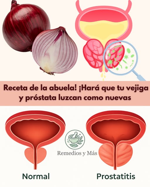 Cebolla y cáscaras para la salud de la vejiga y próstata