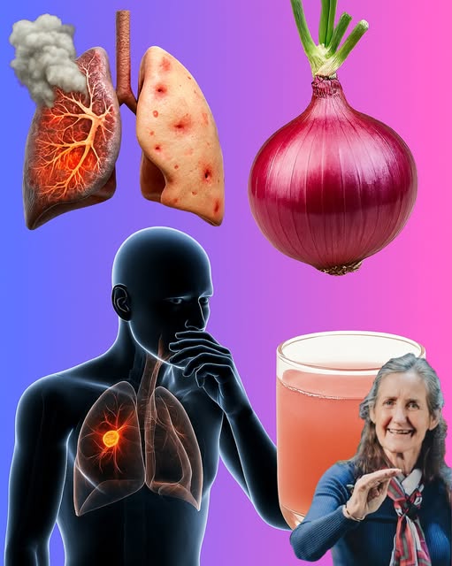 Cebolla como remedio natural para la salud pulmonar