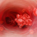 Coagulación sanguínea: síntomas, diagnóstico y remedios naturales