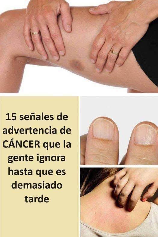 Señales de Advertencia de Cáncer