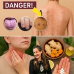 9 Señales de Alerta de Tu Tiroides y Soluciones Naturales