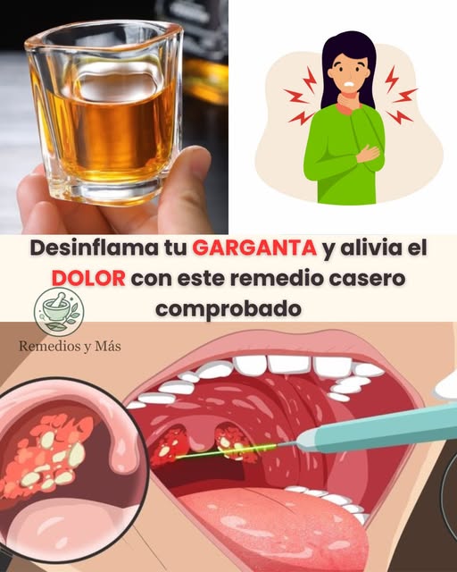 Remedio casero para desinflamar la garganta