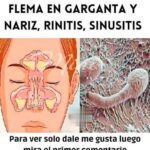 Remedios Caseros para Eliminar Mucosidad y Flema en la Garganta