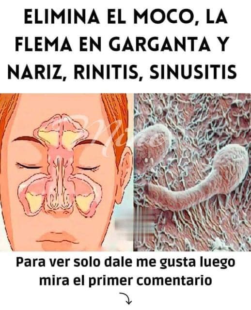 Cavidades nasales y sinusales