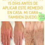 Éstas eran mis manos 15 días antes de aplicar este remedio casero