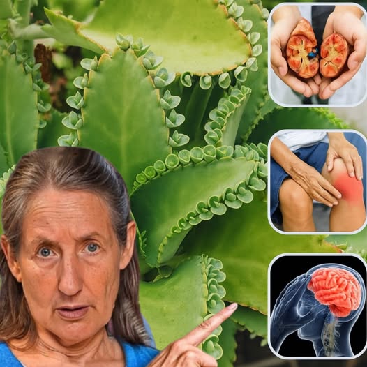 Kalanchoe y sus beneficios para la salud