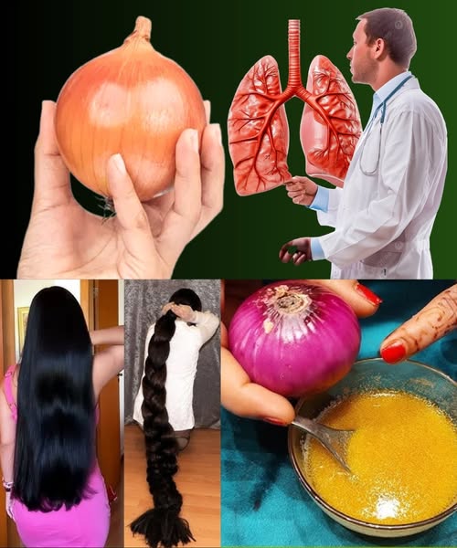 Beneficios de la Cebolla