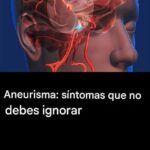 ¿Qué es un Aneurisma? Causas, Síntomas y Cuándo Buscar Ayuda