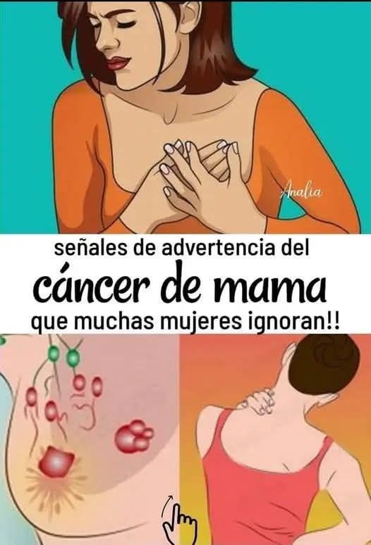 Síntomas del cáncer de mama