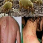 ¿Ácaros en la Cama? Descubre Qué Indican y Cómo Eliminarlos Efectivamente