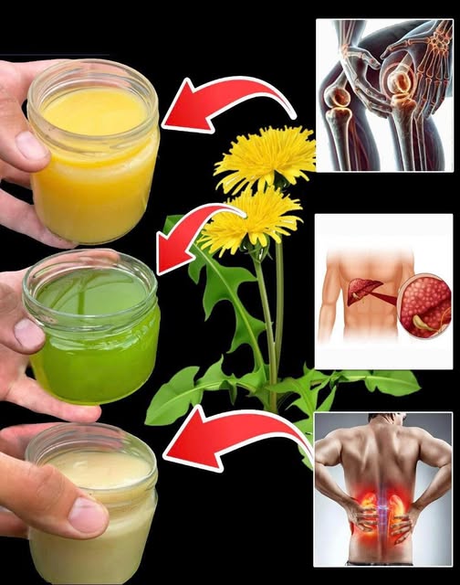 Diente de león y sus beneficios para la salud