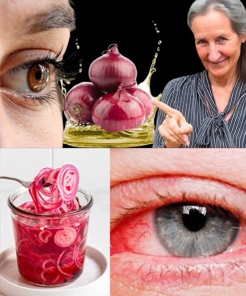 Cebolla roja como remedio natural para la salud ocular