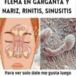 Remedios Caseros para Eliminar Moco y Flema: Soluciones Naturales para la Rinitis y Sinusitis