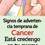 Signos Tempranos de Cáncer: Atentos a tu Cuerpo