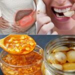 Remedios Naturales para la Insuficiencia Hepática: El Poder del Ajo y la Miel