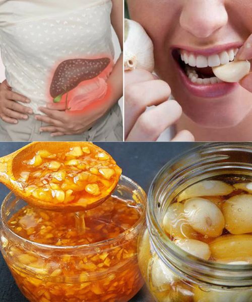 Remedios Naturales para la Insuficiencia Hepática