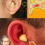 Restaura tu Audición Naturalmente con Ajo y Cebolla—¡Aquí Está el Secreto!