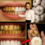 El Secreto que los Dentistas No Quieren que Sepas: Elimina el Sarro y Blanquea tus Dientes en Solo 2 Minutos con Ajo