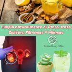 Guía Completa para Limpiar el Útero y Tratar Quistes, Fibromas y Miomas Naturales