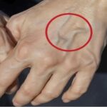 Venas Visibles: Lo Que Tu Cuerpo Está Intentando Decirte