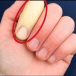 Cuida de tus Manos: Soluciones Naturales para Problemas Circulatorios en los Dedos