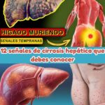 ¿Está Tu Hígado en Peligro? 12 Señales Tempranas de Cirrosis Hepática que No Puedes Ignorar