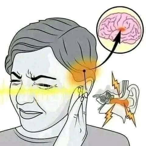 Diagrama sobre el dolor de oído y su relación con el cerebro
