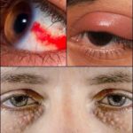 Señales en tus Ojos que Indican Problemas de Salud