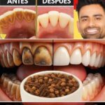 9 Formas Naturales de Eliminar la Placa y el Sarro: Sonríe con Confianza
