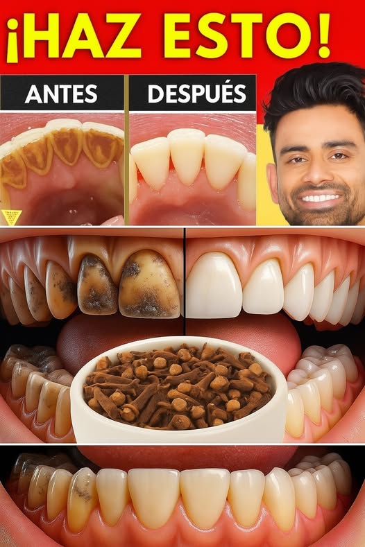 Remedios naturales para mejorar la salud dental