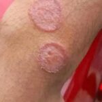 Señales de Enfermedades y Remedios Naturales para el Bienestar