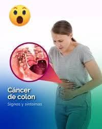 Síntomas de cáncer de colon