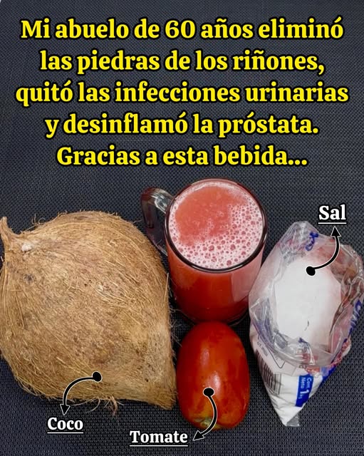 Bebida casera para eliminar piedras renales