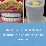 Cómo tener dientes blancos