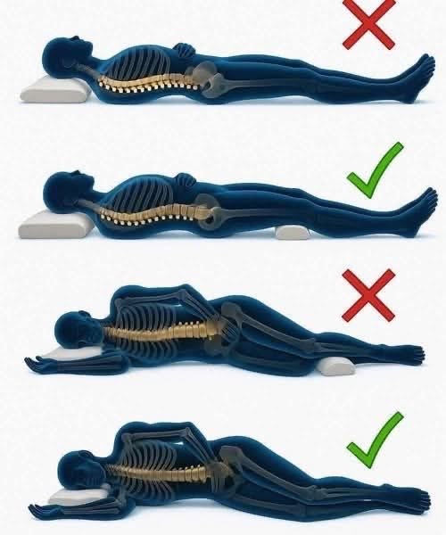 Posiciones adecuadas e inadecuadas para dormir